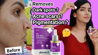 The Derma Co 2 Kojic Acid Serum Review  Best Serum for Dark spots acne scars amp pigmentation [upl. by Ashton]