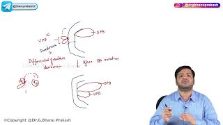 18 Development Of Pancreas  Embryology [upl. by Eirb]