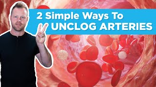 2 Simple Ways To Unclog And Decalcify Your Arteries [upl. by Skerl140]