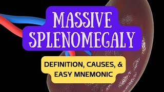 Massive Splenomegaly Enlarged Spleen  Definition Causes and Easy Mnemonic [upl. by Market]