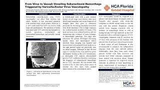 From Virus to Vessel Subarachnoid Hemorrhage Triggered by VaricellaZoster Virus Vasculopathy [upl. by Dearborn]