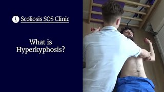 What is Hyperkyphosis  Scheuermanns Disease amp Bad Posture [upl. by Keraj809]