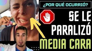 ¿Por qué tiene PARÁLISIS de media cara  Parálisis facial de BELL  shorts [upl. by Aifos]