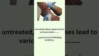 quotUnderstanding Itching Causes amp Effective Treatments at Vein Miraclesquot [upl. by Armington]