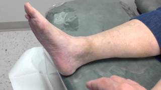 What Causes Chronic Ankle Pain  Bloomington IN Foot Doctor [upl. by Llenad679]