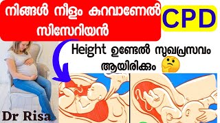 Reason For Cesarean MalayalamCPD In Pregnancy Height Affect Delivery [upl. by Cherin942]