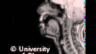 MRI voiced labialvelar approximant [upl. by Carmelia]