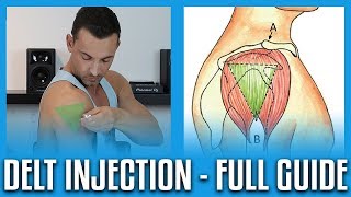 How To Do A Deltoid Injection  Full GuideDemo [upl. by Enirehtacyram]