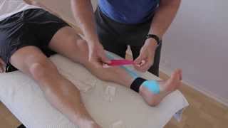 How to treat Anterior Shin Splints with Kinesiology taping [upl. by Gareth]