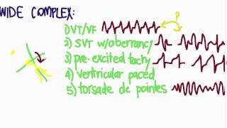 ACLS 10  Tachycardia 3 [upl. by Layney999]