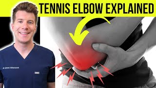 Doctor explains TENNIS ELBOW lateral epicondylitis  Symptoms causes amp treatment [upl. by Nahtnahoj]