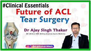 Future of Anterior cruciate ligament ACL Tear Surgery  Essentials of Clinical Orthopedics [upl. by Aivle161]