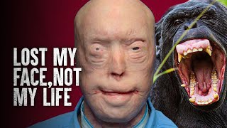 How I Survived a Chimpanzee Attack [upl. by Ahsaela945]