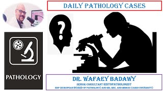 DAILY PATHOLOGY CASES CASE NO7  DR WAFAEY BADAWY [upl. by Nnylirej]