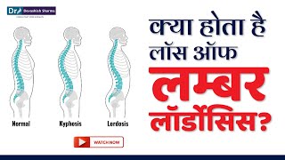 क्या होता है Loss of Lumbar Lordosis Spine Treatment In Noida DelhiNCR amp AgraDr Devashish Sharma [upl. by Esmerolda270]