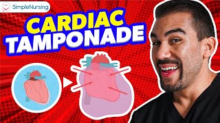 Cardiac Tamponade NCLEX Tips for Nursing Students [upl. by Marius725]