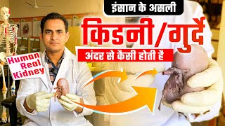 HUMAN REAL KIDNEY amp KIDNEY STONES  किडनीगुर्दे अंदर से कैसी होती है और इसमें पथरी कहाँ बनती है [upl. by Prudie85]