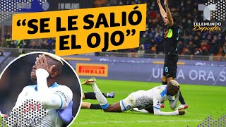 Escalofriante lesión de jugador del Napoli “se le salió el ojo”  Telemundo Deportes [upl. by Candice803]