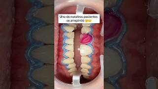 Estás a tiempo de realizarte un blanqueamiento dental 🦷 [upl. by Eisaj801]