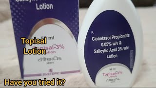 Topisal lotion for dry flaky scalp [upl. by Booze782]