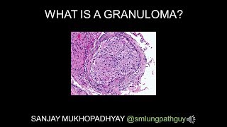 What is a granuloma [upl. by Gregoor]