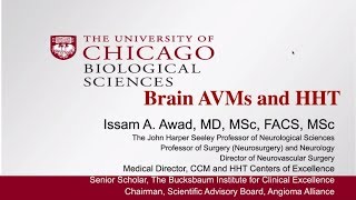 Screening and Treatment of Brain AVMs in HHT [upl. by Enetsirhc]