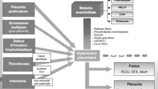 GYNECOLOGIE Pré – éclampsie [upl. by Ajit933]