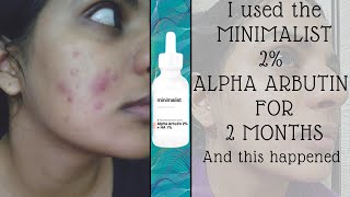 MINIMALIST ALPHA ARBUTIN 2 MONTH REVIEW [upl. by Llerred]