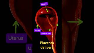 Delivery of the placenta pregnant placenta baby [upl. by Oderfla]