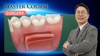 Master Course  SURGERY How to Successfully Master FGG and CTG Procedures [upl. by Enidanreb474]