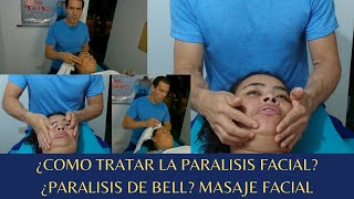 Masaje facial para parálisis de Bell [upl. by Payne]