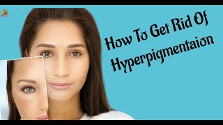 The ULTIMATE Routine for Dark Spots  Hyperpigmentation and Melasma Guide by Lalitha USA Vlogs [upl. by Etnaik968]