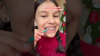 How to Take Off Braces Rubber Band Using Braces Rubber Band Placer [upl. by Fira143]