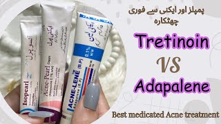 Best Acne Fighting Products  Medicated Acne Treatment  Dermatologist Recommended Creams [upl. by Zeb]