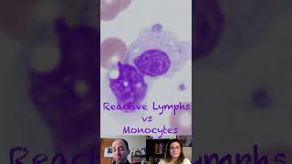 Reactive Lymphocytes versus Monocytes [upl. by Nanon]