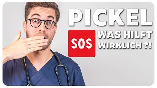 Pickel SOS  Was hilft wirklich  Doc Mo [upl. by Fidelis]