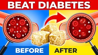 How To Beat Diabetes In 4 Easy Steps [upl. by Yonatan]