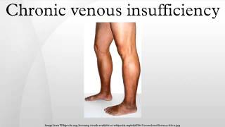 Chronic venous insufficiency [upl. by Nickey]