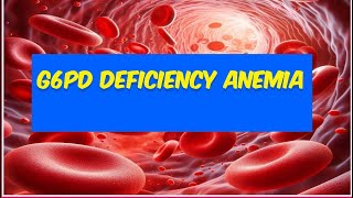 G6PD deficiency hemolytic anemia [upl. by Hindorff]