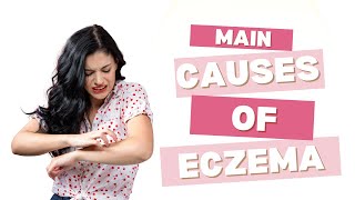 Top Causes of Eczema What Triggers This Common Skin Condition [upl. by Ybok542]