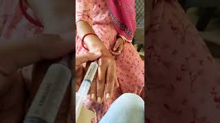 INTRAVENOUS INJECTION PROCEDURE ll INTRAVENOUS INJECTION demonstration ll IV INJECTION ll video ll [upl. by Enitsyrk181]