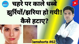 चहरे पर काले धब्बे झुर्रियों तथा झाइया हो गयी कैसे हटाए Shorts lamshorts [upl. by Neelasor]