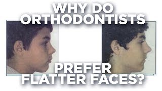 Orthodontics flattens your face [upl. by Tench]