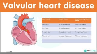 Valvular Heart Diseases Classification Causes Pathophysiology Diagnosis and Treatment [upl. by Aseram]