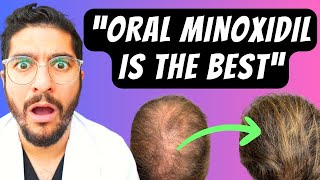 99 Miss This NEW Hair Loss Treatment – Dermatologist Explains [upl. by Millan]