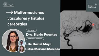 Malformaciones vasculares y fístulas cerebrales por la Dra Karla Fuentes [upl. by Magnusson]