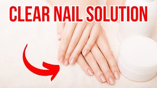 Home Treatment for Nail Fungus Get Rid of 17 Fungal Infections for Good [upl. by Milson]