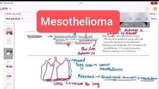 Mesothelioma pathology Respiratory 41  First Aid USMLE Step 1 in UrduHindi [upl. by Garth]