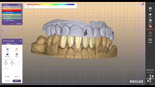 Millbox DentalWingsDwos Invivo FreeformPlus BlueSkyPlan Onyxceph CoDiagnostiX [upl. by Sehguh]