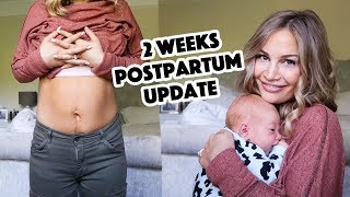 2 Week Postpartum Update [upl. by Bael]